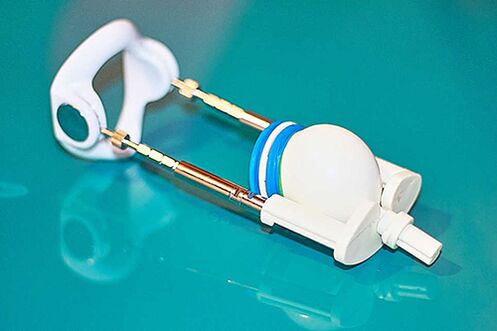 Extensor ein Gerät für eine effektive Erhöhung eines Mitglieds